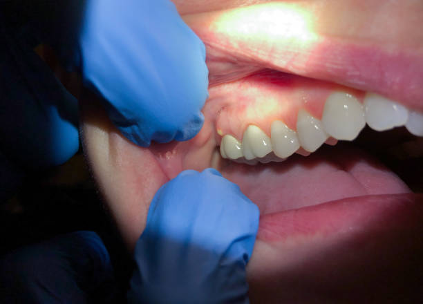 Best Urgent Tooth Repair  in Murphy, NC