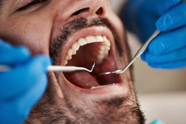 Best Emergency Gum Pain Relief  in Murphy, NC